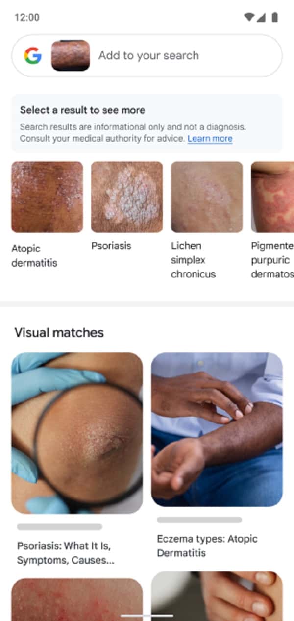 Google Lens ganha função que identifica problemas de pele (Foto: Reprodução / TechCrunch)