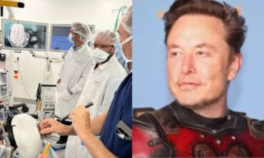 Neuralink, empresa de Elon Musk, inicia testes em humanos de chips cerebrais
