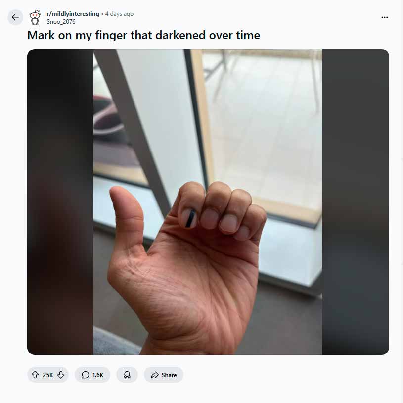 Photo: Reddit / Snoo_2076