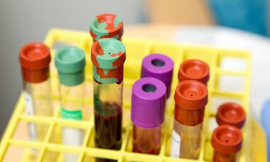 Universidade no Japão começa testes clínicos de "sangue artificial"; entenda