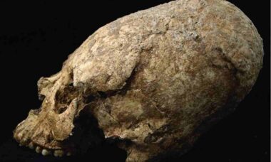 Pesquisadores encontram crânio cônico de 6 mil anos com ferimento misterioso