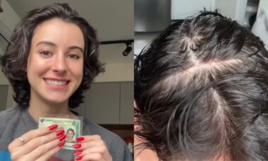 Influenciadora trans viraliza após mostrar as cicatrizes de sua cirurgia de feminização facial