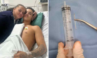 Jovem sobrevive após acidentalmente disparar pistola de pregos no próprio coração e história viraliza