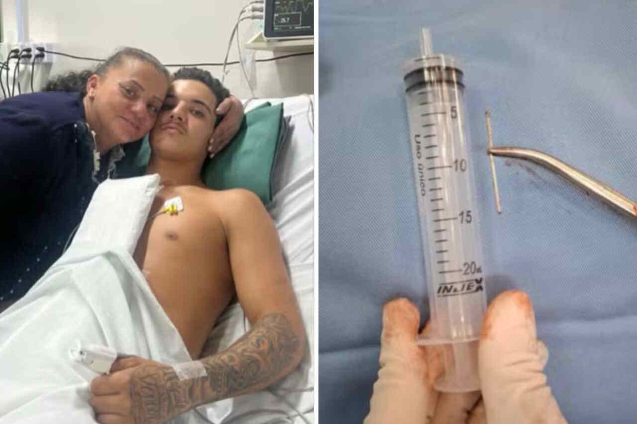 Jovem sobrevive após acidentalmente disparar pregos no próprio coração e história viraliza