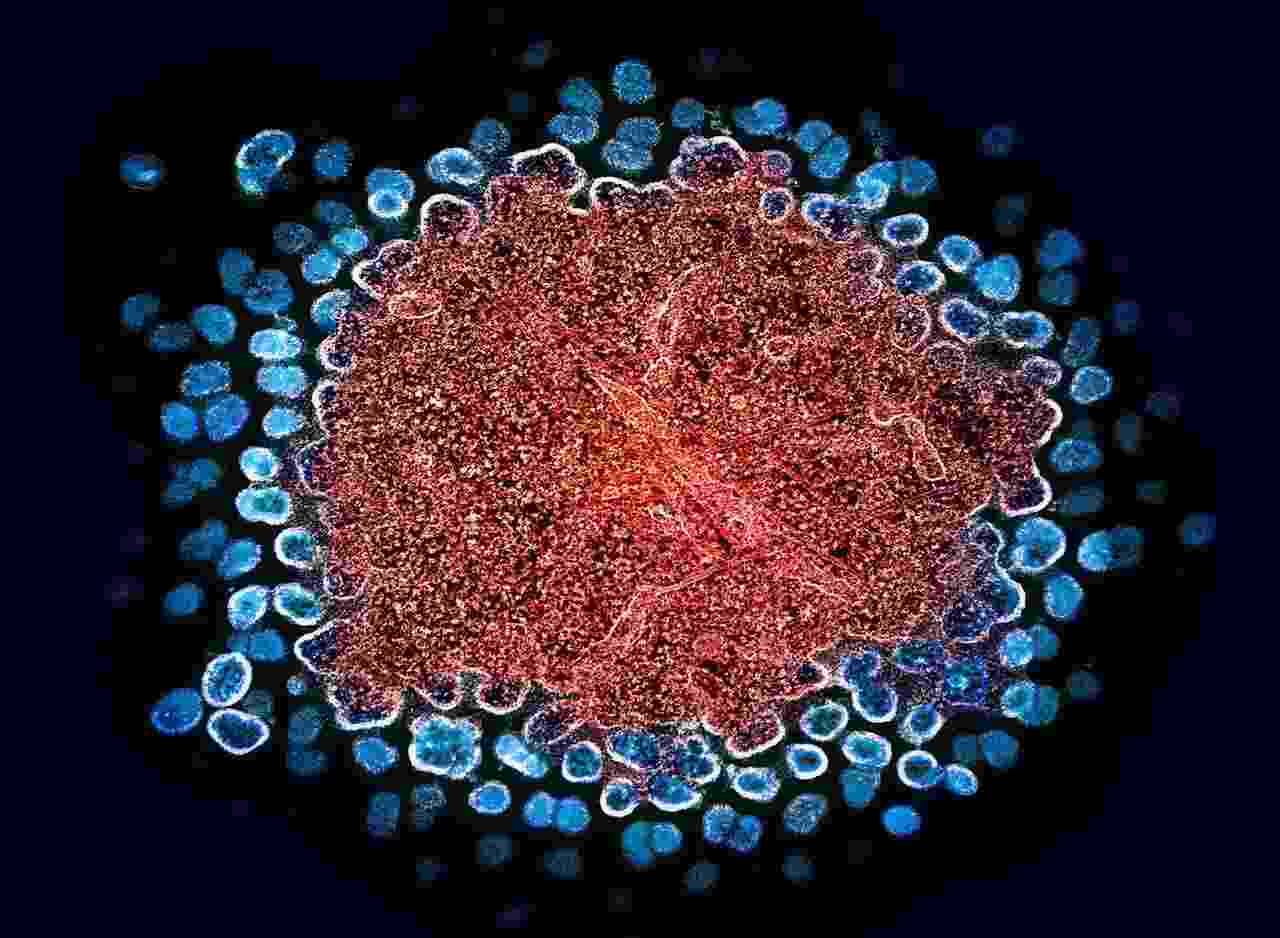 Anteriormente considerado imposible, científicos están cerca de una cura para el VIH