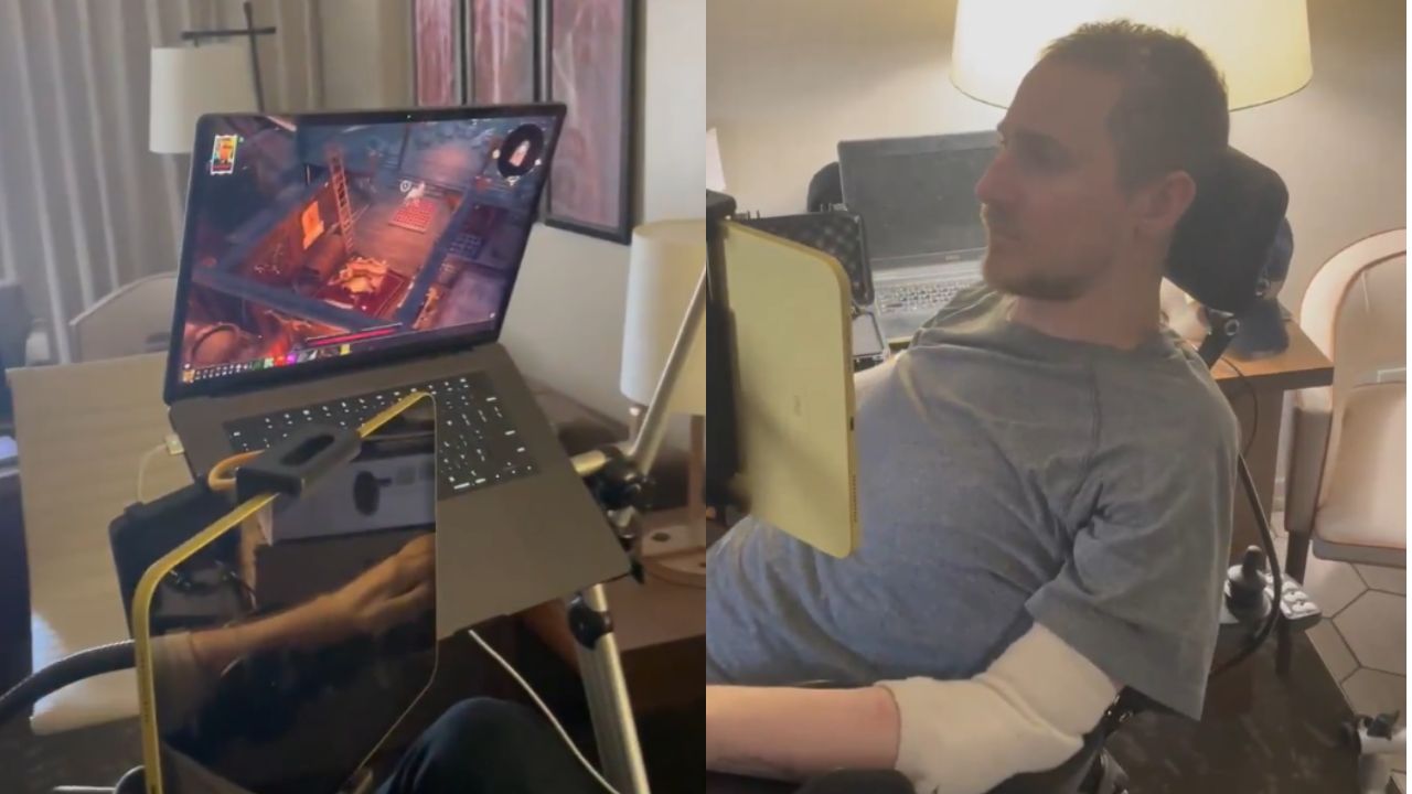 Vídeo viral mostra implante Neuralink de Elon Musk funcionando para jogar videogame