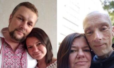 Soldado ucraniano mostra fotos de antes e depois de ser capturado pela Rússia e imagens viralizam