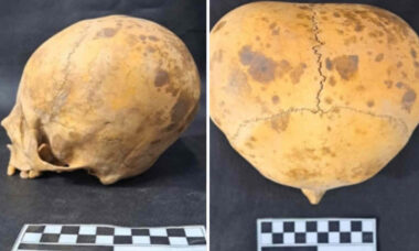 Cientistas descobrem mais informações sobre o crânio de "alien" encontrado na Argentina