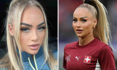 Alisha Lehmann, jogadora mais seguida do mundo, é criticada após supostos procedimentos estéticos